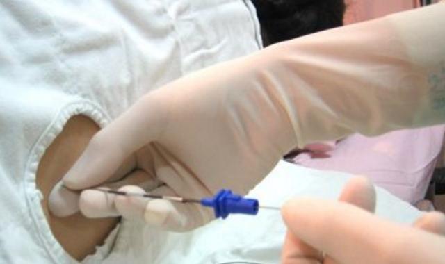 女人生孩子可以选择剖腹产吗,为什么女人生孩子会选择剖腹产