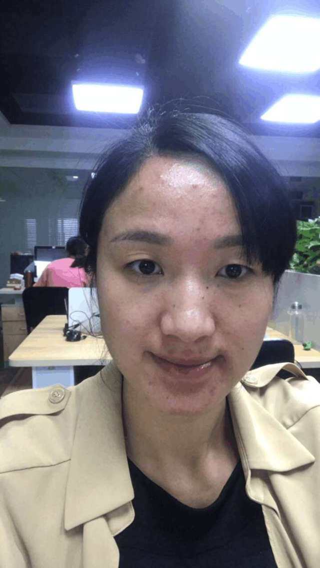 养好皮肤有气色,养好了皮肤