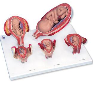 如果要打胎需要双方家长签字吗,一定要做人流怎么办