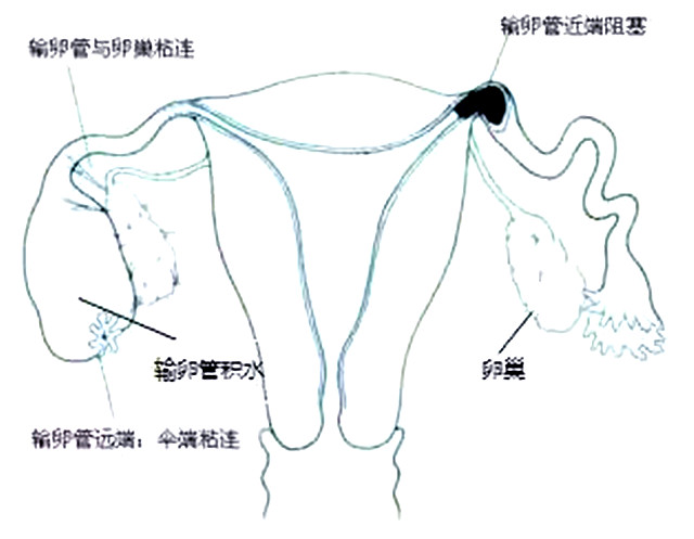 孕期肚子疼怎么判断是不是便秘,孕期肚子疼是不是先兆流产