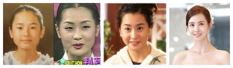 值不值得去韩国整容,韩国整容比中国便宜吗