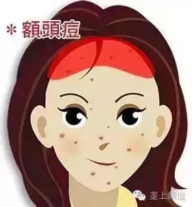 脸上长痘痘可以用醋洗脸吗,用醋洗面会长痘