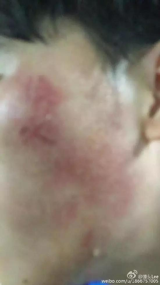 江苏苏宁被打,江苏苏宁球员最新消息