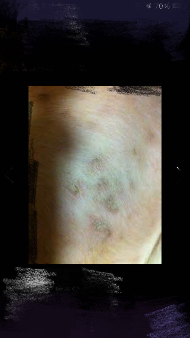 宠物医生如何预防狂犬病,宠物猫狗在什么环境下会得皮肤病