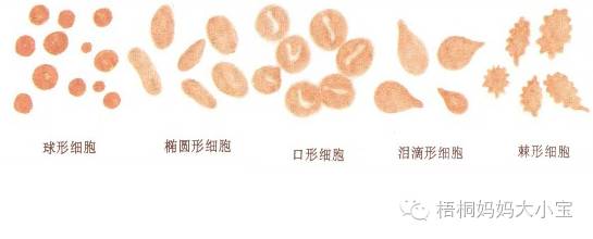 宝宝血色素正常值是多少,贫血血色素低是什么原因造成的