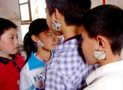 孩子得了腮腺炎可以吃鸡蛋吗,儿童腮腺炎会感染大人吗