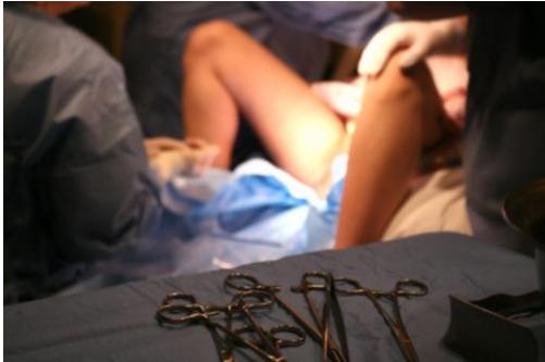 女人怕顺产侧切,为什么有的女的觉得顺产很丢人