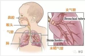 肺炎双胞胎姐妹,9个月宝宝母亲发烧去世