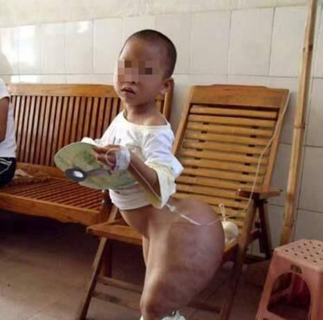 5岁女儿医院抢救无效,5岁女儿得绝症父亲却不去看一眼