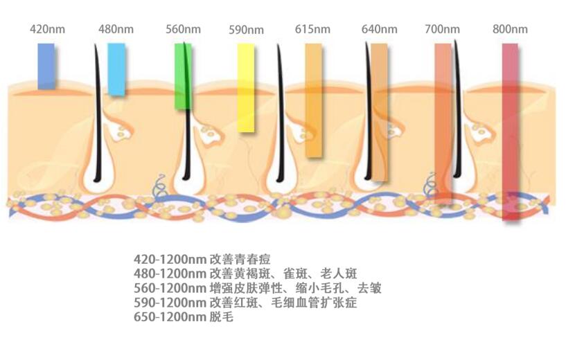 ipl光子嫩肤仪器多少钱,光子嫩肤的价格一般是多少