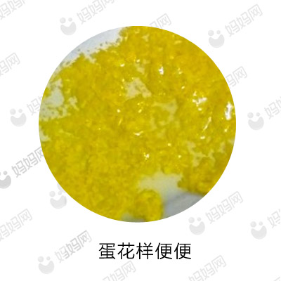 宝宝拉这几种便便要去医院,宝宝有问题的便便是怎样的