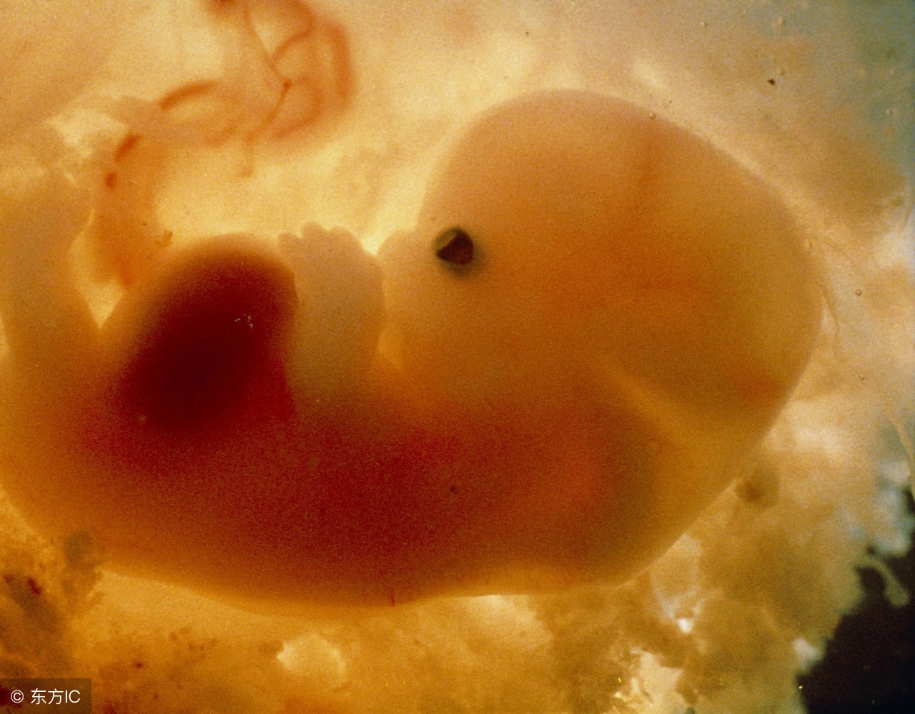 正常生育一孩后反复自然流产,多次自然流产需要做什么检查