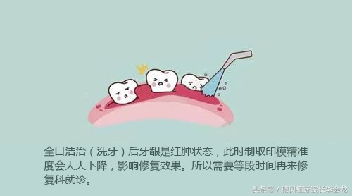 镶牙没镶好能卸掉重镶吗,镶牙只镶一个