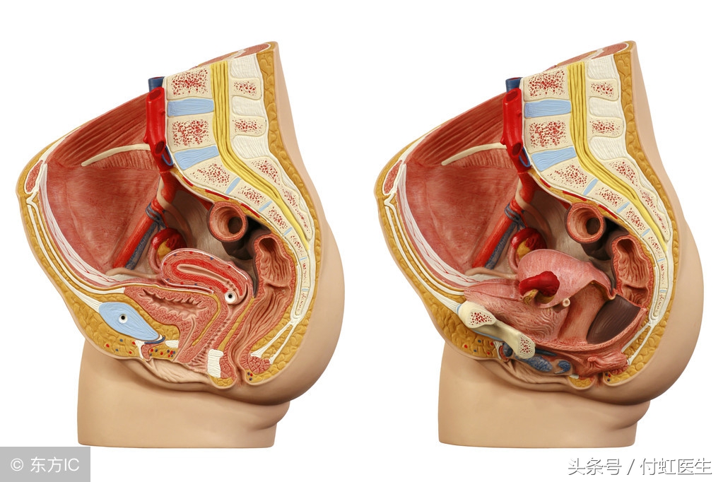 b超显示有积液是先兆流产么,刚怀孕去做b超查出盆腔积液