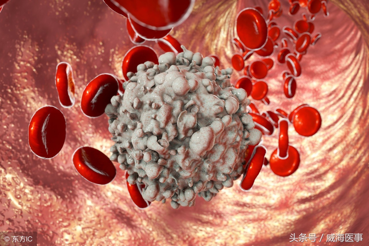 赞:威海市立医院多学科协作成功救治白血病合并真菌感染