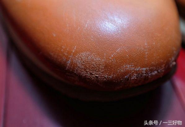 白鞋自然发黄,黑鞋白底发黄怎么办