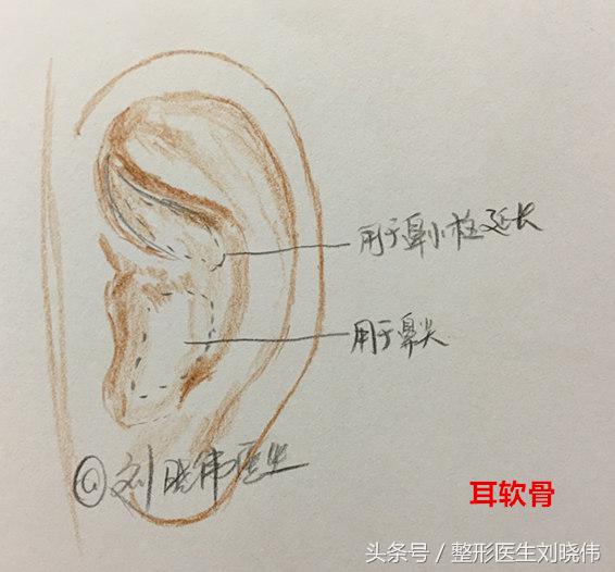 小鼻综合和大鼻综合的区别,鼻整形科普