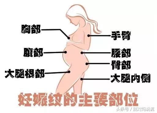 不油腻的妊娠纹霜,帕玛氏妊娠纹油和妊娠纹霜哪个好