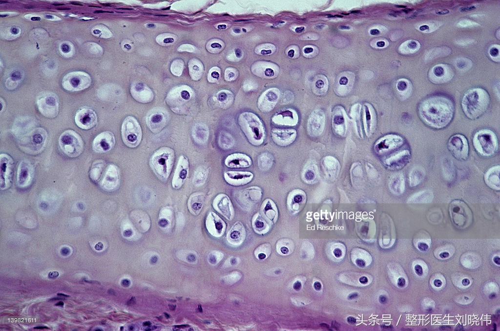 小鼻综合和大鼻综合的区别,鼻整形科普