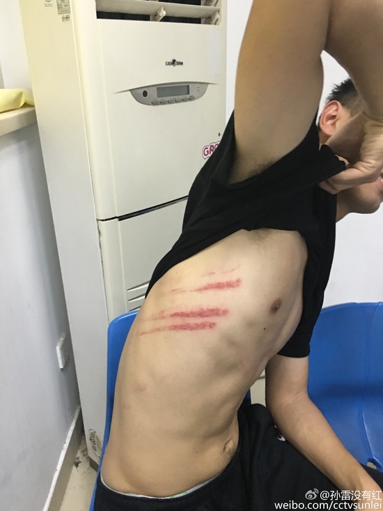 苏宁足球被打,江苏苏宁球员和对方发生冲突