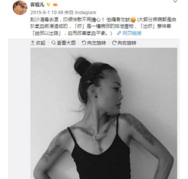 闃垮▏鏅掑埉鐥ф不鐤楃収,闃垮▏鑴搁儴鍒棫