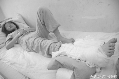 脚踝骨折取钢板后还用打石膏吗,距骨骨折固定钢板后多久拆除石膏