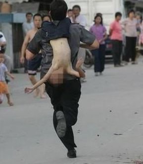 两岁孩子被父母用开水灌喉治病，偏方真会害死人