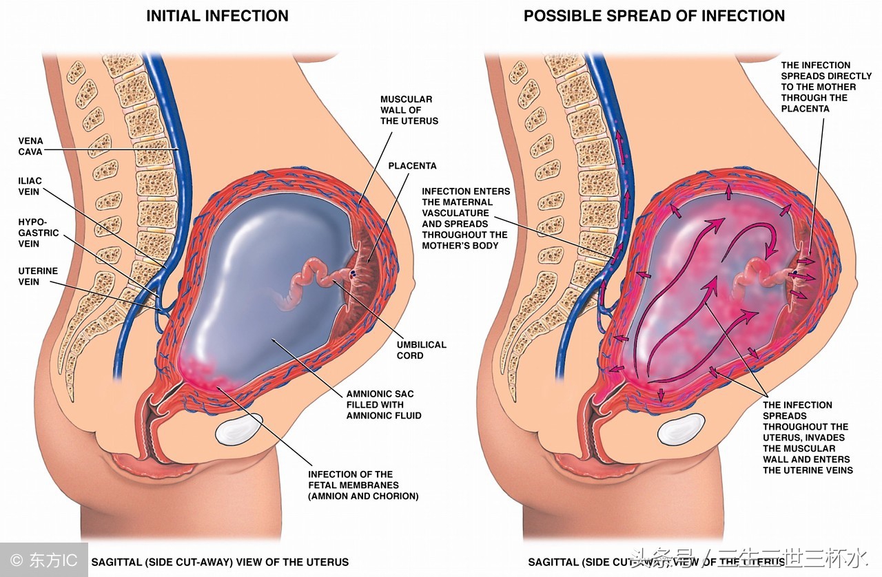 孕期准妈有这3种情况,孕期准妈妈会有什么怪