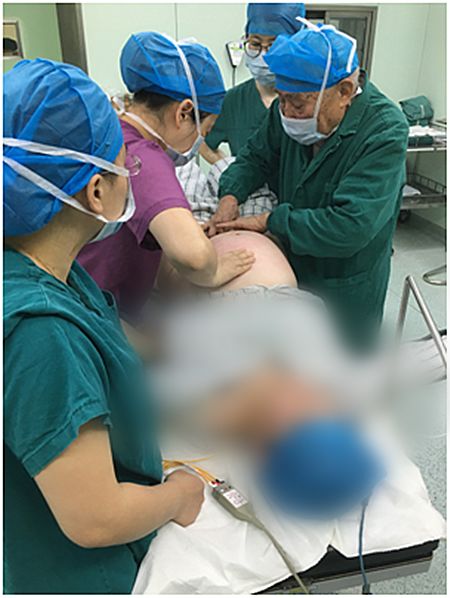 预产期要到了宝宝jio朝外？产科这套“乾坤大挪移”帮宝宝转身！