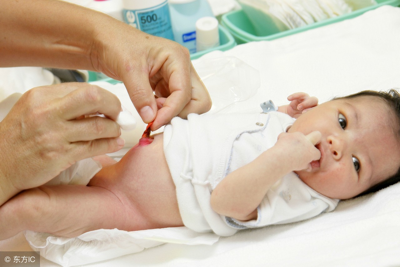 新生儿常见6大问题注意事项,新生儿满百天有什么禁忌