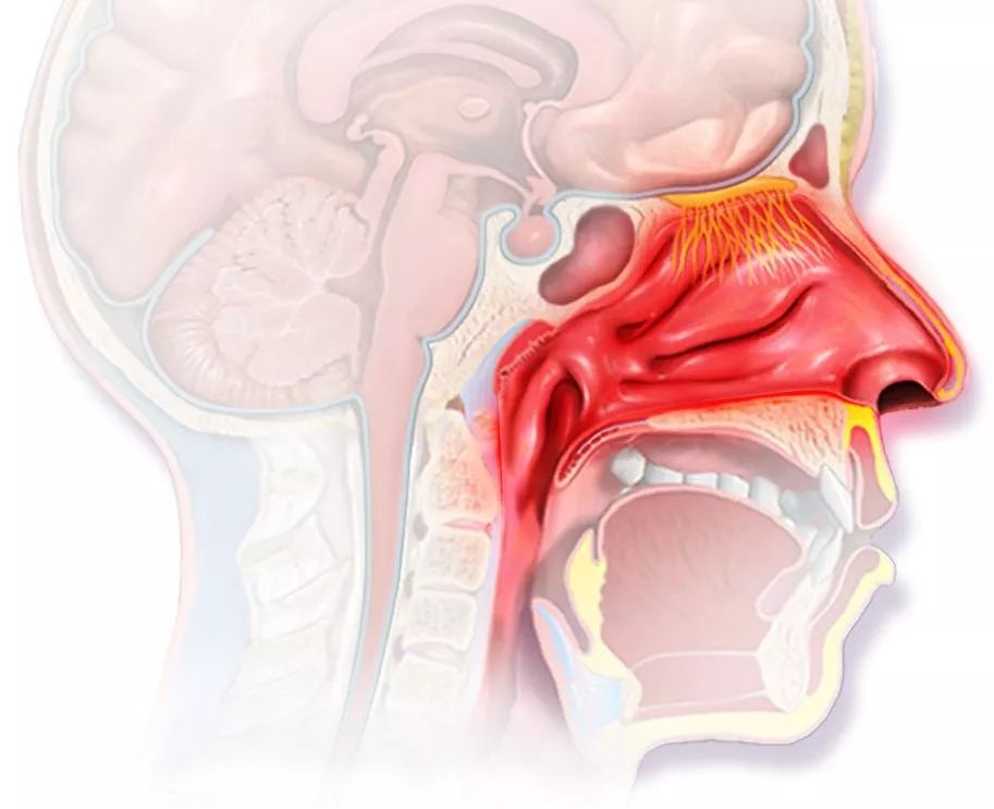 流感来势汹汹教你如何远离流感,新一波的流感咳嗽怎么缓解