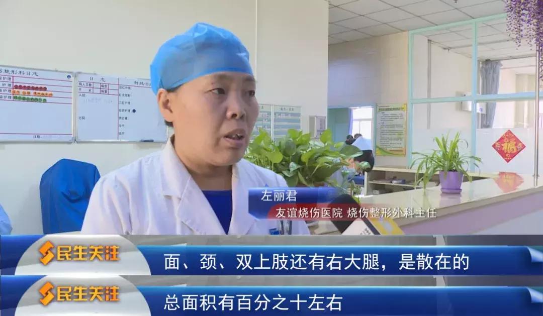 女婴被开水严重烫伤众人伸出援手,7岁女孩高速爱心接力