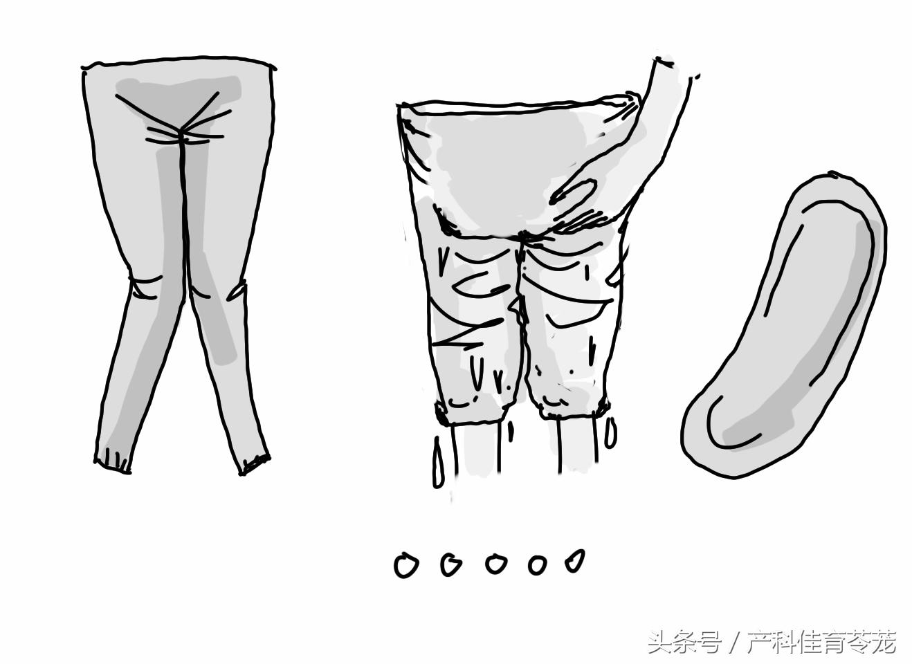 外阴瘙痒可以自愈吗,外阴瘙痒怎么治才会好啊