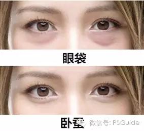 卧蚕和眼袋的区别对照图,眼袋和卧蚕什么区别