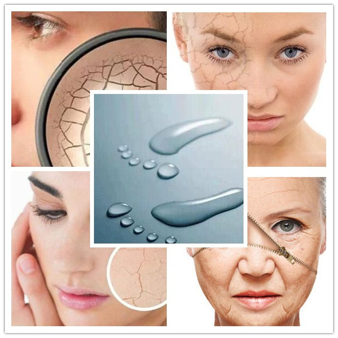 肌肤缺水的原因及解决方法,脸部肌肤缺水如何补水