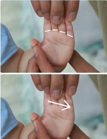 小儿推拿止咳化痰手法图解,小儿推拿三分钟退烧手法图解