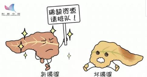 脐带干细胞治疗糖尿病神经病变,脐带干细胞治疗糖尿病效果好吗