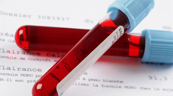 健康评估心脏检查操作,健康评估心电图检查重点知识