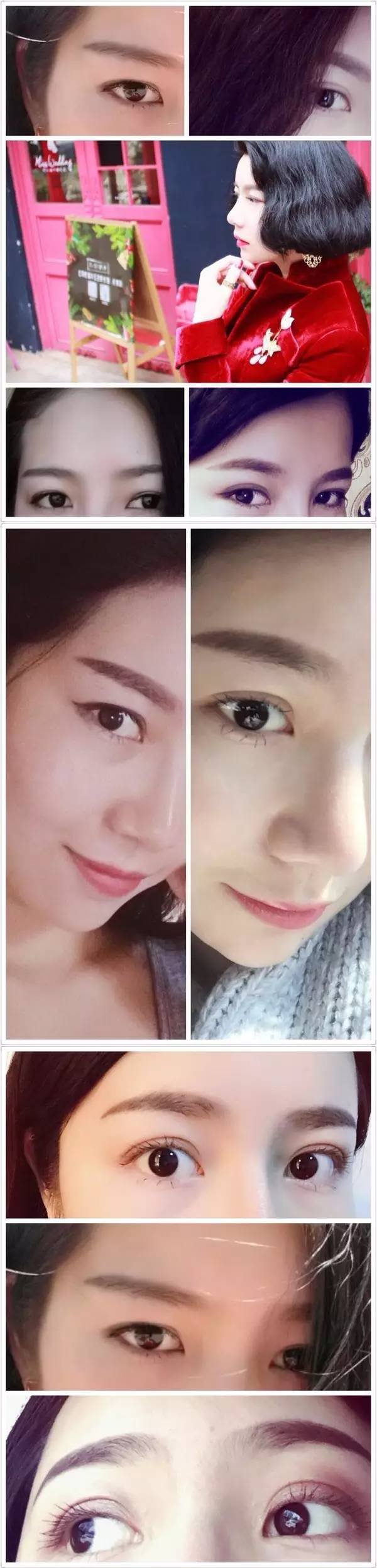 内双如何自然地变成双眼皮?