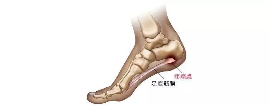 有的人为了残奥会去截肢,有些情况为什么要截肢