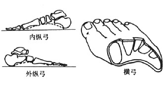 扁平足需要垫足弓吗,扁平足足弓套有用吗