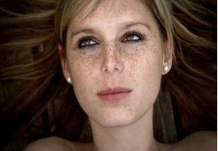 雀斑怎么祛除不花钱1天就好,祛除老年斑色斑雀斑的好方法