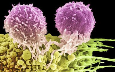 抗癌疫苗价格一览表,肿瘤疫苗新闻最新消息