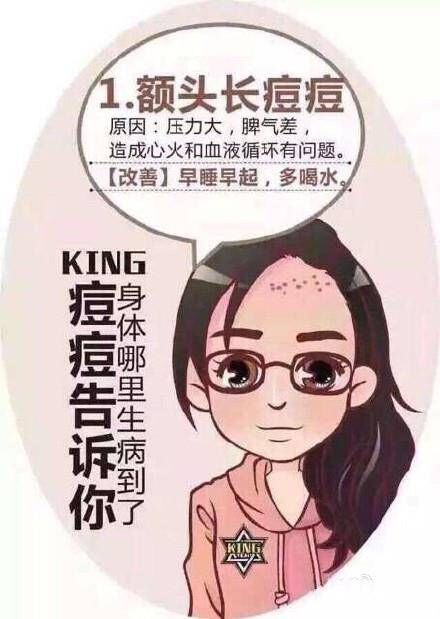 脸上痘痘分布说明身体什么问题,专家讲解痘痘经验