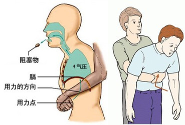 孩子误服异物怎么提示家长,婴儿误服药物异物怎么办
