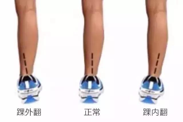 选鞋不当危害,亚瑟士跑鞋适合外翻还是内翻