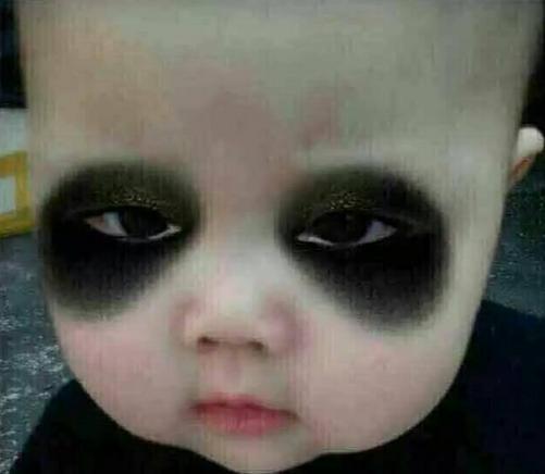 黑眼圈缺少什么,黑眼圈是什么原因造成的怎么调理