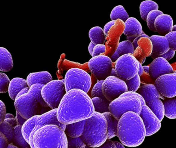 5种食物有助预防妇科病,赶走妇科病最好的食疗