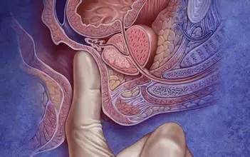 “*菊爆**花”的检查项目尴尬又难受,到底要不要放弃?