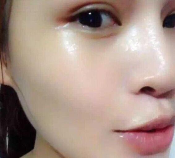 满脸斑淡斑并不难试试这个方法,淡斑小妙招长斑的女人快来看看吧